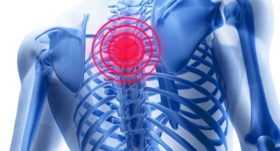Treatment of osteochondrosis of the thoracic spine