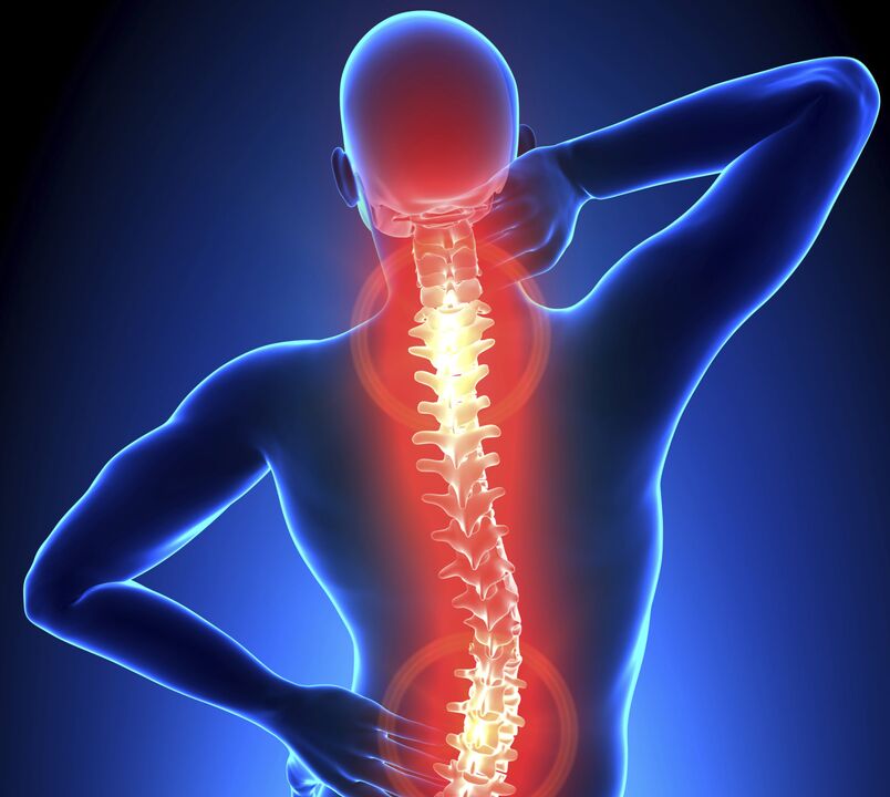 Osteochondrosis of the spine
